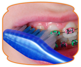 aparate dentare indreptat dinti stomatologie craiova medic stomatolog cabinet stomatologic